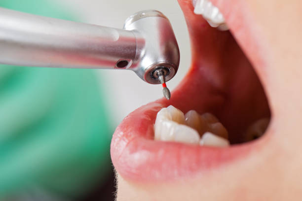 Best Cracked Tooth Emergency Dentist  in Paterson, NJ